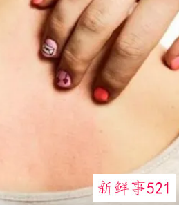 背部长痘哪里需要排毒