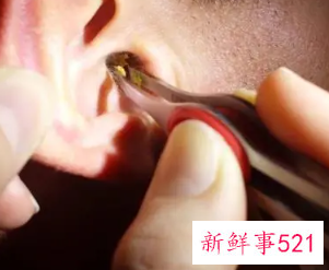 清理耳屎去医院挂什么科