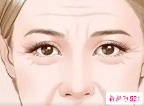 除皱针打了注意哪些问题