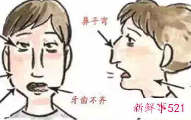 张嘴睡觉嘴唇会变厚吗
