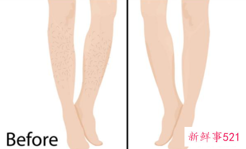 学生怎么去腿毛