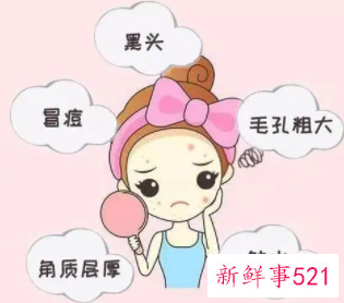 油性皮肤用什么面膜比较好