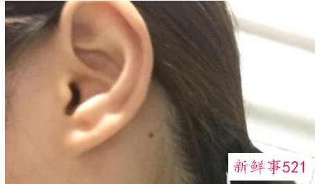 男人左耳发烫是什么预兆