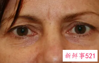 让五官年轻10岁的保养小窍门