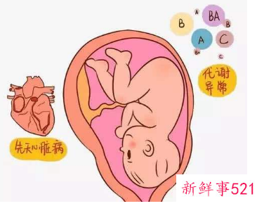 胎儿先天性疾病是怎么回事