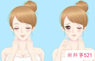 黄褐斑怎样有效去除