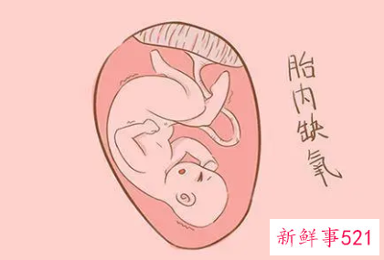 胎动强烈怎样区别缺氧