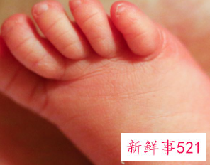 小孩经常咬手指甲