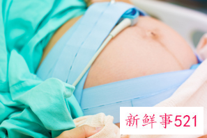 剖腹产老公可以陪产吗