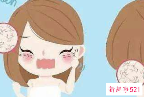 坚持用这个方法可以缓解消除痘印