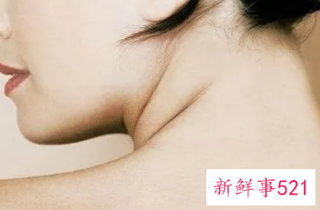 怎样才能改善脖子的颈纹