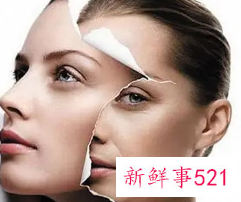 皮肤如何补充胶原蛋白