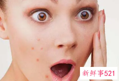 未成年脸上长痘痘怎么调理