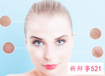 毛孔粗大有黑头了怎么办