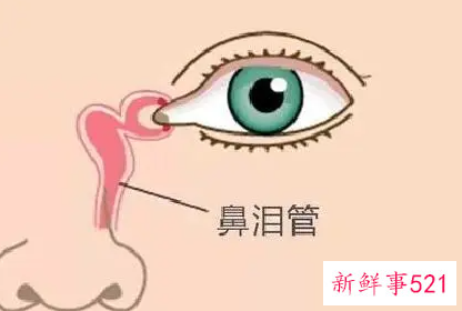 怎么预防婴儿泪道堵塞