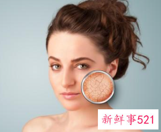 毛孔粗大有黑头了怎么办