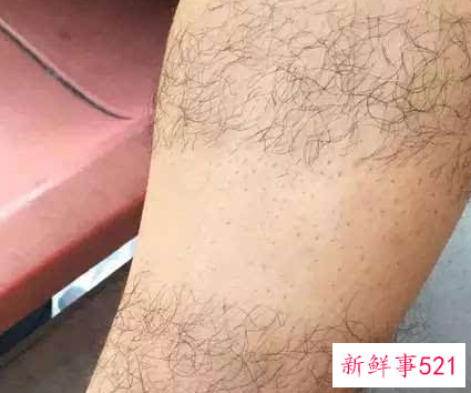 学生怎么去腿毛