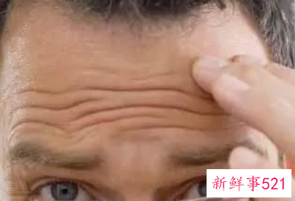 额头皱纹怎么去除额头有皱纹怎么办