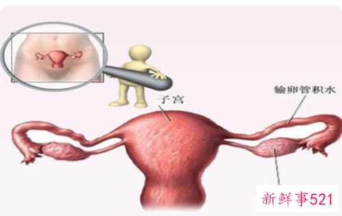 女性有妇科病什么症状