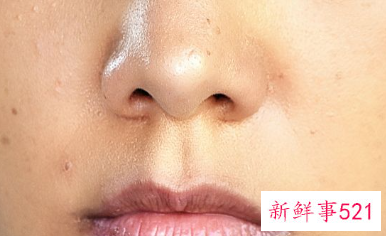 女人脸色暗黄有斑怎么调理