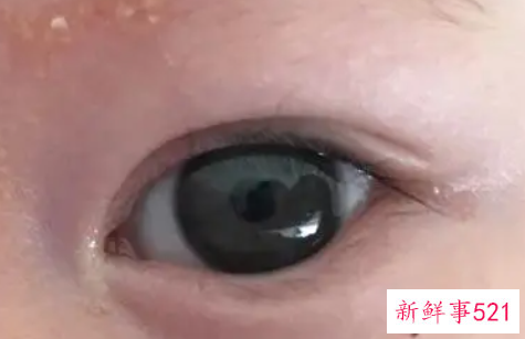 治疗宝宝皮肤干的措施有哪些