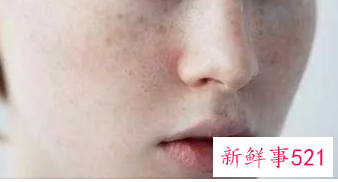 女人脸色暗黄有斑怎么调理