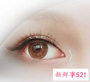 双眼皮前窄后宽是什么眼型