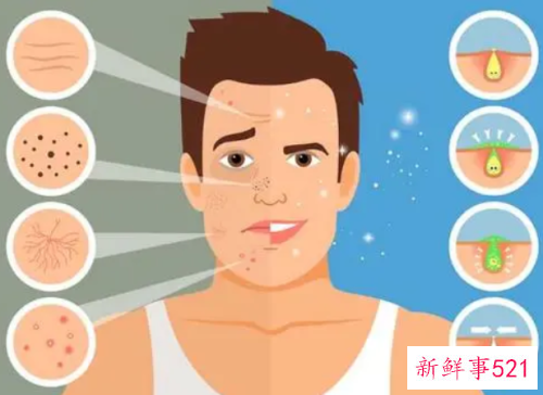 如何把男性脸上的痘痘都去除掉