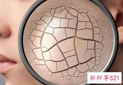 冬天脸上脱皮用什么好