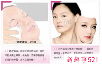 黑脸娃娃淡化黑色素效果好