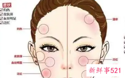 敏感肌长痘痘怎么办