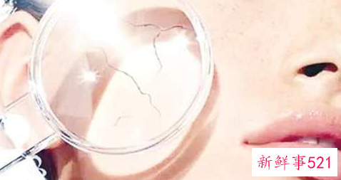 炎热夏季暴晒后肌肤如何修复