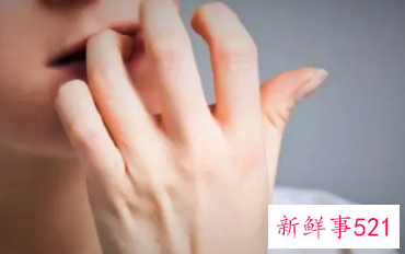 强迫性皮肤剥离症的表现