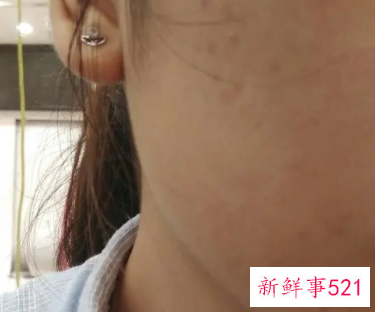 全身黑怎么内调变白