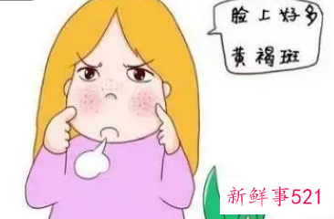 黄褐斑怎样有效去除