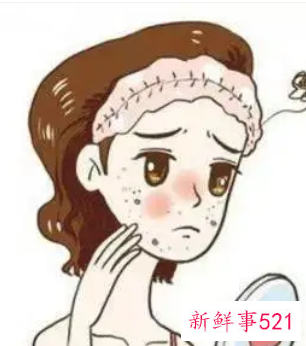 怎么让雀斑消失