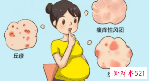 孕妇皮肤过敏了怎么办