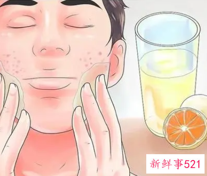 坚持用这个方法可以缓解消除痘印