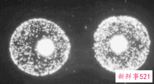 人为什么会衰老