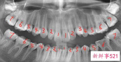 正常情况下人有几颗牙齿