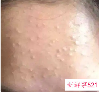 闭口什么样子图片