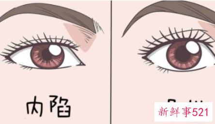 如何测自己的眼型