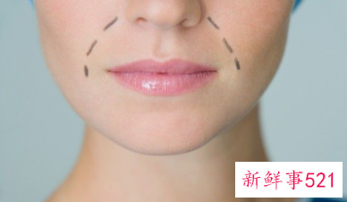 该如何正确改善法令纹