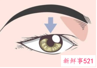 如何测自己的眼型