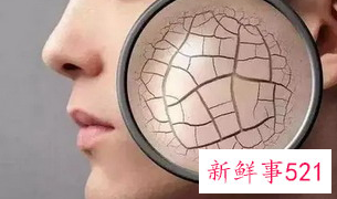 春天皮肤干燥什么原因造成的缺什么