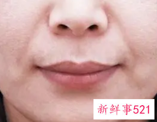 该如何正确改善法令纹