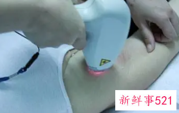 脱毛仪一次打几遍