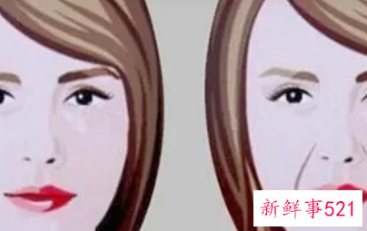 皮肤下垂法令纹严重怎么办