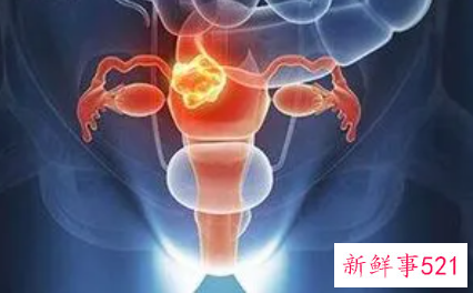 女性卵巢在什么位置