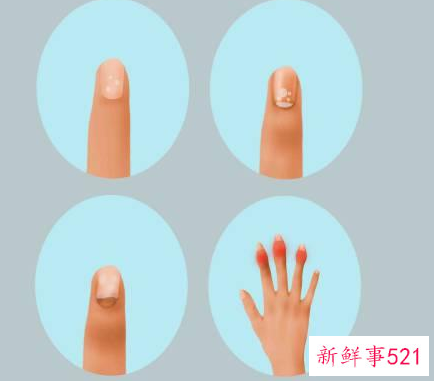 抹指甲油对指甲好吗